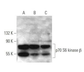 p70 S6 kinase &beta; Antibody (164CT21.2.2) - Western Blotting - Image 374574