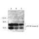 p70 S6 kinase β Antibody (164CT21.2.2) - Western Blotting - Image 374574