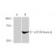 p70 S6 kinase β Antibody (4B11) - Western Blotting - Image 347573 