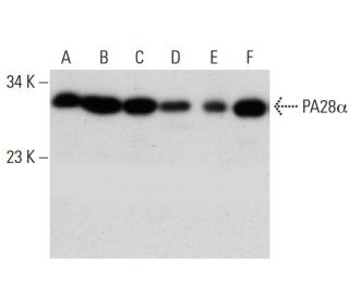 PA28&alpha; Antibody (AT12H3) - Western Blotting - Image 384546 