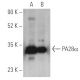 PA28α Antibody (G-9) - Western Blotting - Image 400817 