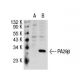PA28β Antibody (A8) - Western Blotting - Image 31516