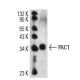 PAC-1 Antibody (4O21) - Western Blotting - Image 14287