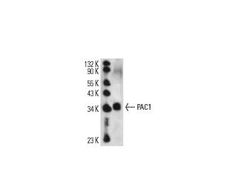 PAC-1 Antibody (4O21) - Western Blotting - Image 14287Each CRISPR/Cas9 Knockout (KO) Plasmid product consists of a pool of 3 plasmids designed to ensure identification and cleavage of a specific gene for maximum knockout efficiency. Each plasmid encodes a unique 20 nt sequence derived from the GeCKO (v2) library.