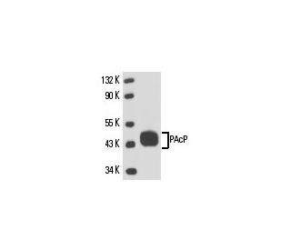 PAcP Antibody (PAP03) - Western Blotting - Image 15871
