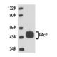 PAcP Antibody (PAP03) - Western Blotting - Image 15871