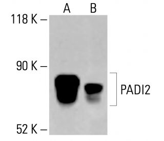 PADI2 Antibody (4D4) - Western Blotting - Image 414181 