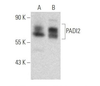 PADI2 Antibody (4D4) - Western Blotting - Image 367983