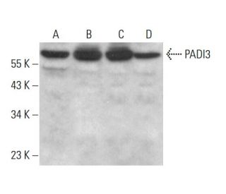 PADI3 Antibody (F-6) - Western Blotting - Image 383902 