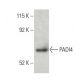PADI4 Antibody (C-3) - Western Blotting - Image 397548 