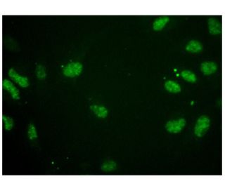 pADPr Antibody (10H) - Immunofluorescence - Image 306512