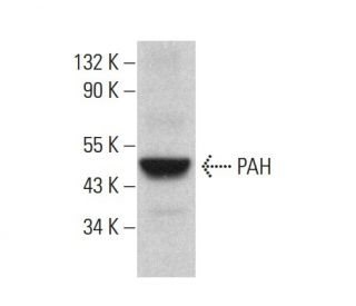 PAH Antibody (H-2) - Western Blotting - Image 383749 
