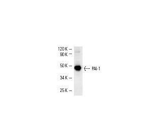 PAI-1/SERPINE1 Antibody (C-9) - Western Blotting - Image 3496