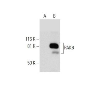 PAK6 Antibody (C-2) - Western Blotting - Image 292075