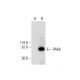 PAK6 Antibody (H-6) - Western Blotting - Image 292020 