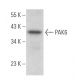 PAK6 Antibody (H-6) - Western Blotting - Image 371500