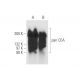 pan CEA Antibody (4/3/17) - Western Blotting - Image 57996 