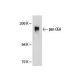 pan CEA Antibody (D14HD11) - Western Blotting - Image 21326
