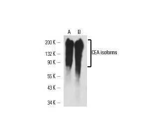 pan CEA Antibody (TET2) - Western Blotting - Image 14768 