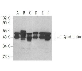 pan-Cytokeratin Antibody (7H8C4) - Western Blotting - Image 352389 