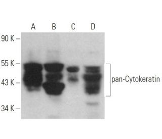 pan-Cytokeratin Antibody (AE1/AE3) - Western Blotting - Image 360889 