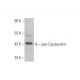 pan-Cytokeratin Antibody (AE13) - Western Blotting - Image 352382