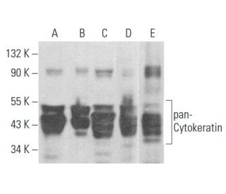 pan-Cytokeratin Antibody (B311.1) - Western Blotting - Image 354545 