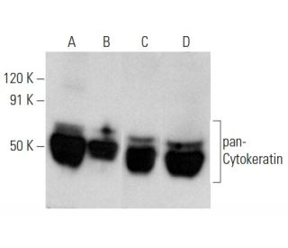pan-Cytokeratin Antibody (C11) - Western Blotting - Image 354292 