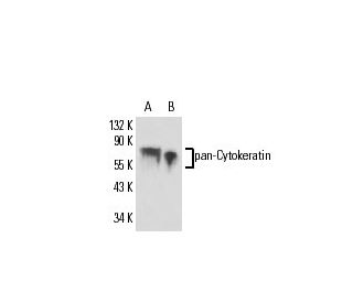 pan-Cytokeratin Antibody (HEP 111) - Western Blotting - Image 17230 