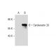 pan-Cytokeratin Antibody (HEP 111) - Western Blotting - Image 65250