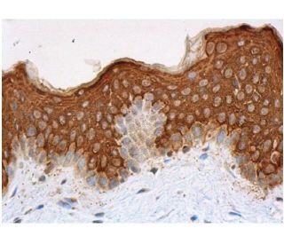 pan-Cytokeratin Antibody (K20) - Immunohistochemistry - Image 356404 