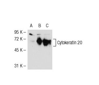 pan-Cytokeratin Antibody (PK63) - Western Blotting - Image 51507 