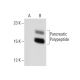 Pancreatic Polypeptide Antibody (030-06-1) - Western Blotting - Image 65366