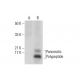 Pancreatic Polypeptide Antibody (B-2) - Western Blotting - Image 317947