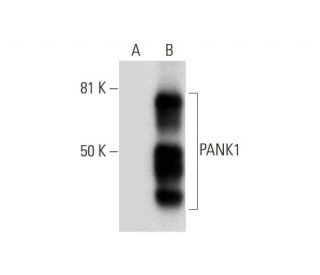 PANK1/2 Antibody (C-4) - Western Blotting - Image 289600