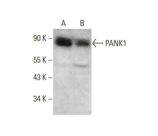 PANK1 Antibody (B-9) - Western Blotting - Image 377468 