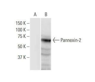 Pannexin-2 Antibody (2B11) - Western Blotting - Image 352201 