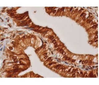 PAPSS 1 Antibody (A-2) - Immunohistochemistry - Image 286289 