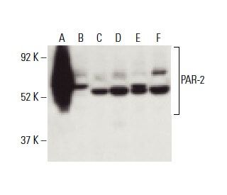 PAR-2 Antibody (SAM11) - Western Blotting - Image 398264 
