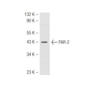 PAR-2 Antibody (SAM11) - Western Blotting - Image 48164