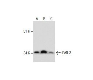 PAR-3 Antibody (8E8) - Western Blotting - Image 285862