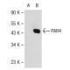 PAR4 Antibody (3G9H7) - Western Blotting - Image 109939 