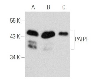 PAR4 Antibody (3G9H7) - Western Blotting - Image 354830 