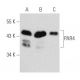 PAR4 Antibody (3G9H7) - Western Blotting - Image 354830 