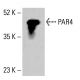 PAR4 Antibody (3G9H7) - Western Blotting - Image 413404