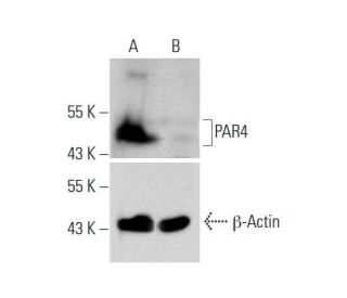 PAR4 HDR Plasmid (h): sc-401142-HDR. Western blot analysis of PAR4 expression in non-transfected control (A) and puromycin