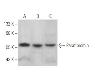 Parafibromin Antibody (E-12) - Western Blotting - Image 377002 