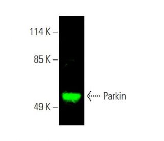 Parkin Antibody (PRK8) - Western Blotting - Image 388249 