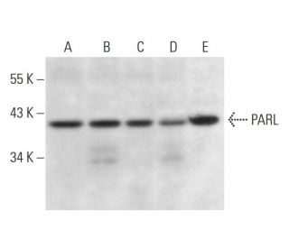 PARL Antibody (F-3) - Western Blotting - Image 333422