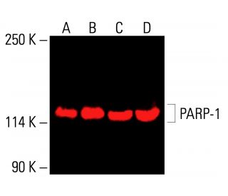 PARP1 Antibody (5A5) - Western Blotting - Image 416267 